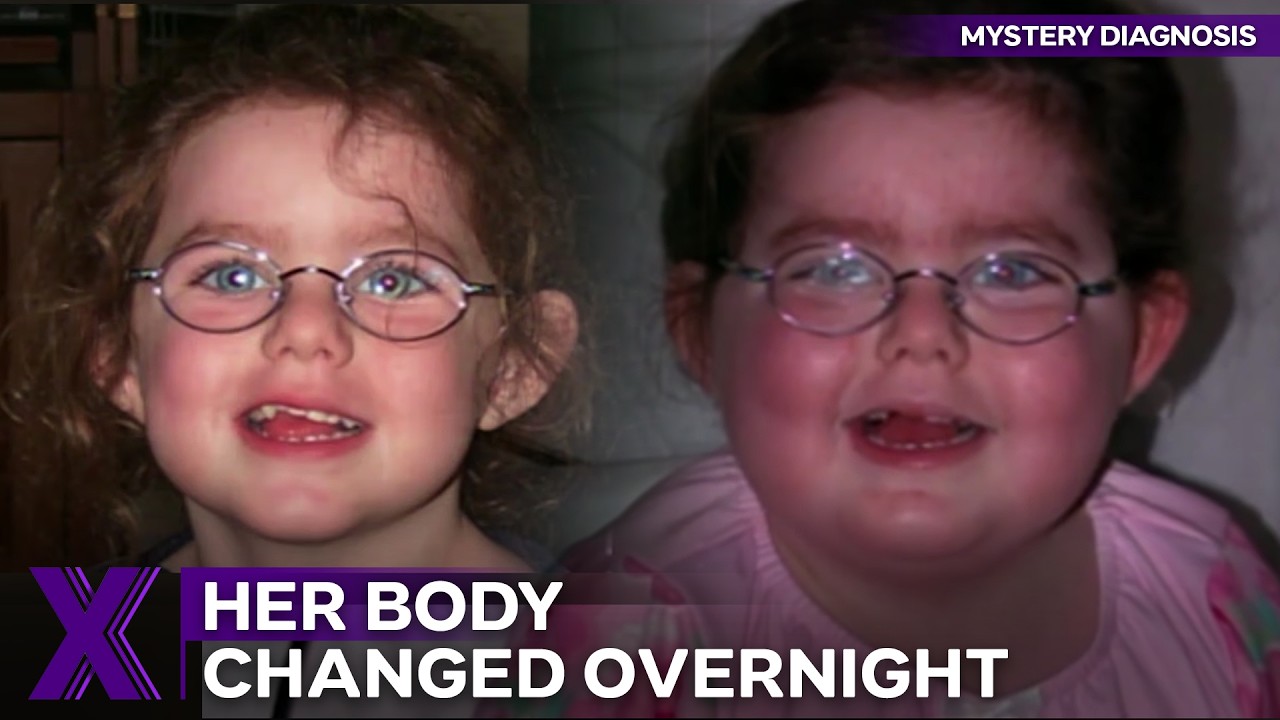 Doctors Thought The Mother Was Crazy | Mystery Diagnosis