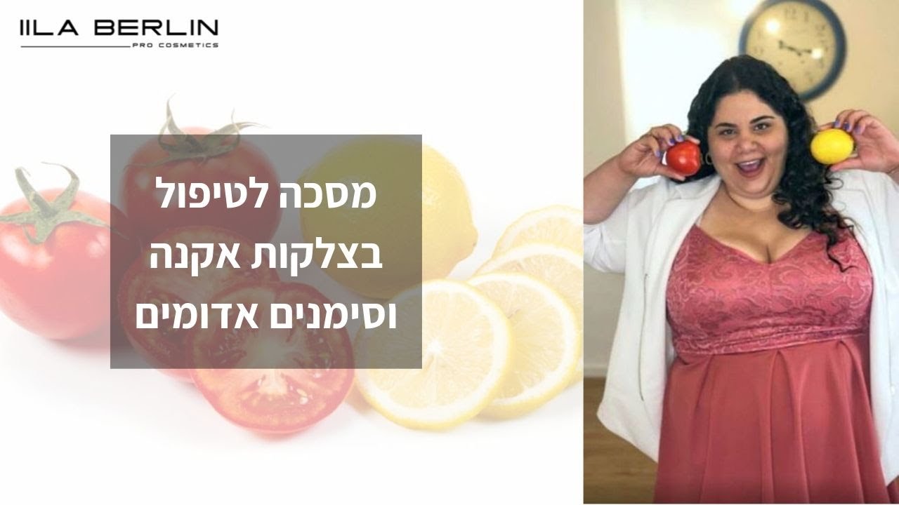 מסכה לטיפול בצלקות אקנה וסימנים אדומים