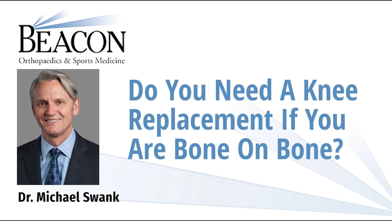 Do You Need a Knee Replacement if You Are Bone on Bone?