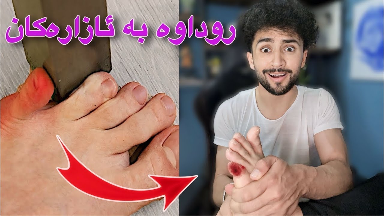 ئازارەکانی ھەموومان لە یەک ڤیدیۆ | بەسەرت ھاتوە دلنیام😂