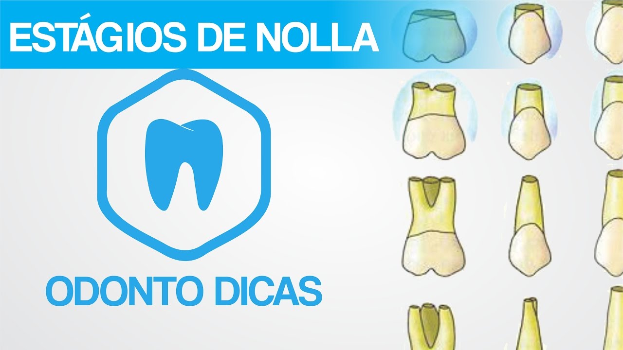 ESTÁGIOS DE NOLLA - VÍDEO EXTRA EM COMEMORAÇÃO AOS PRIMEIROS 100 INSCRITOS | ODONTO DICAS