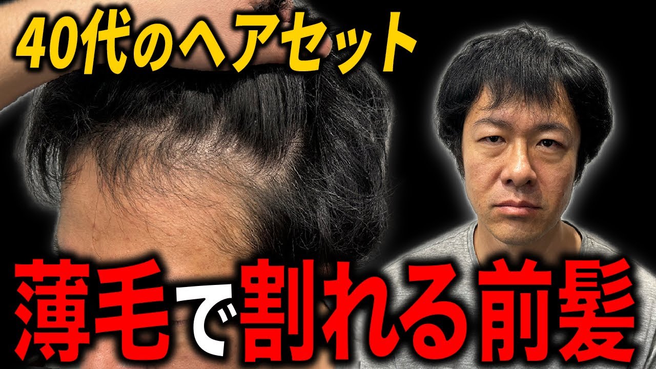 【40代薄毛】髪が薄く、前髪が割れて見えないヘアセットで若返る！