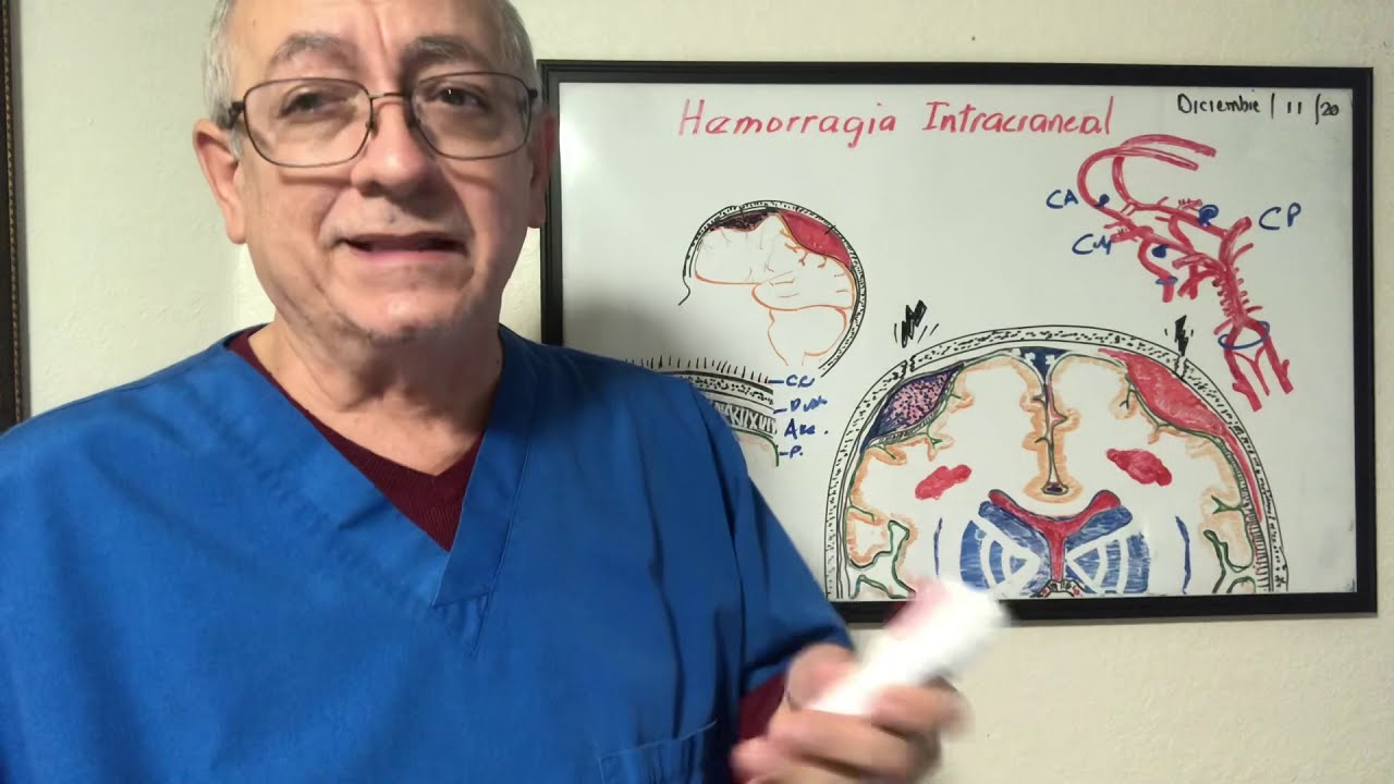 Hemorragia intracraneal. Clasificación