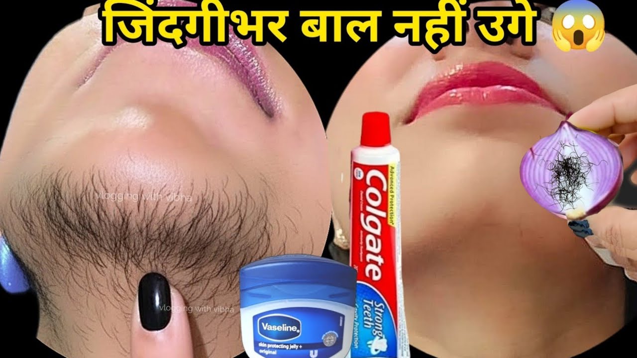 Vaseline से बिना दर्द चेहरे के बाल निकालने का आसान तरीका 😱 Dr. ने बताया | Facial Hair Removal