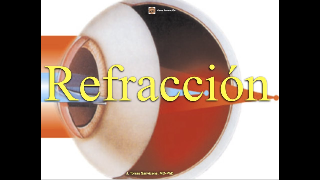 Refracción.