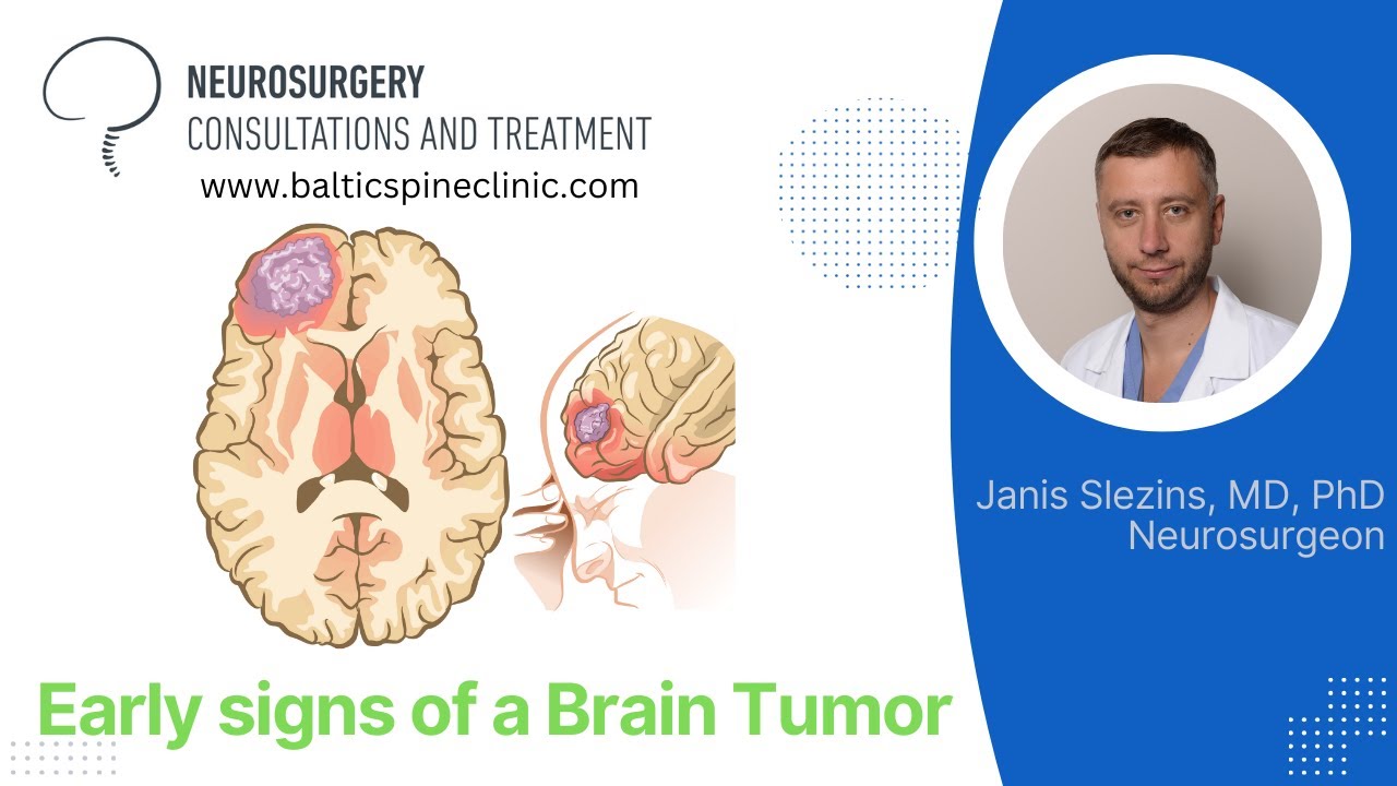 Early signs of a brain tumor (How can brain tumor manifest at early stages).