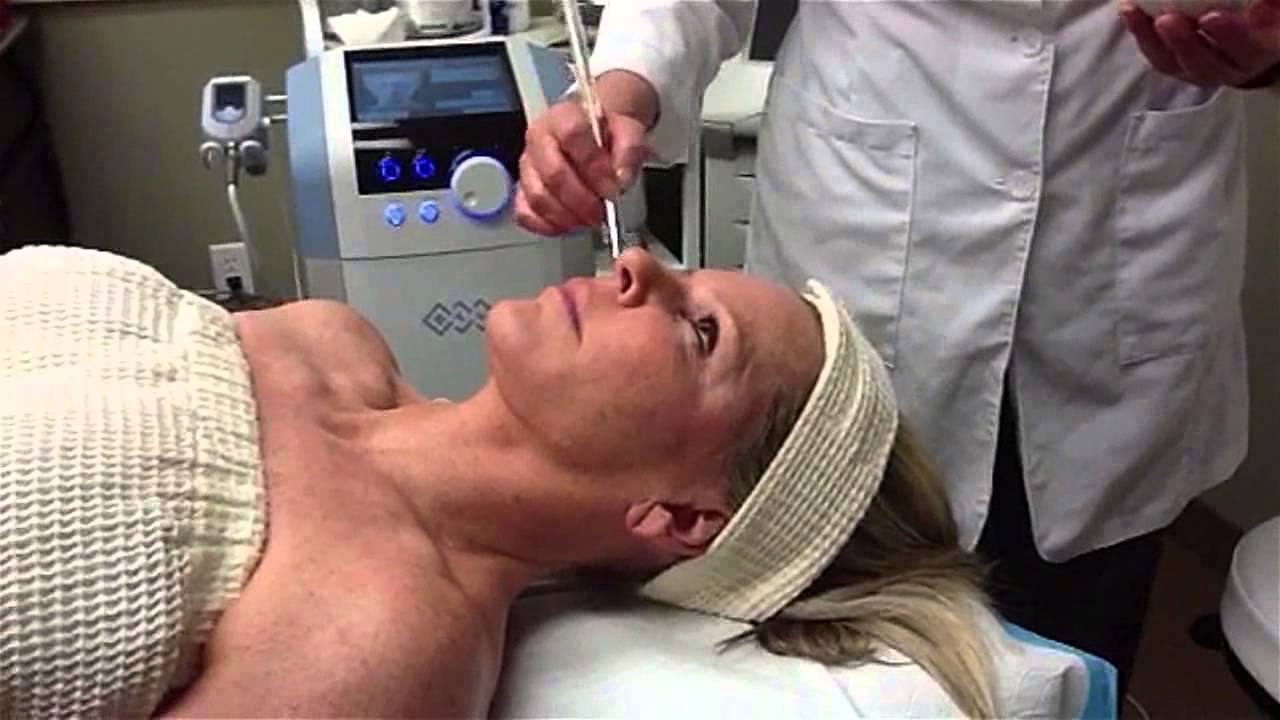 Exilis for Skin tightening & body contouring, RenovoMD, Northborough, MA