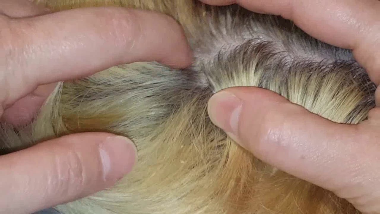 Dandruff scalp scratching picking with fingernails & comb on my son ASMR hair little talking