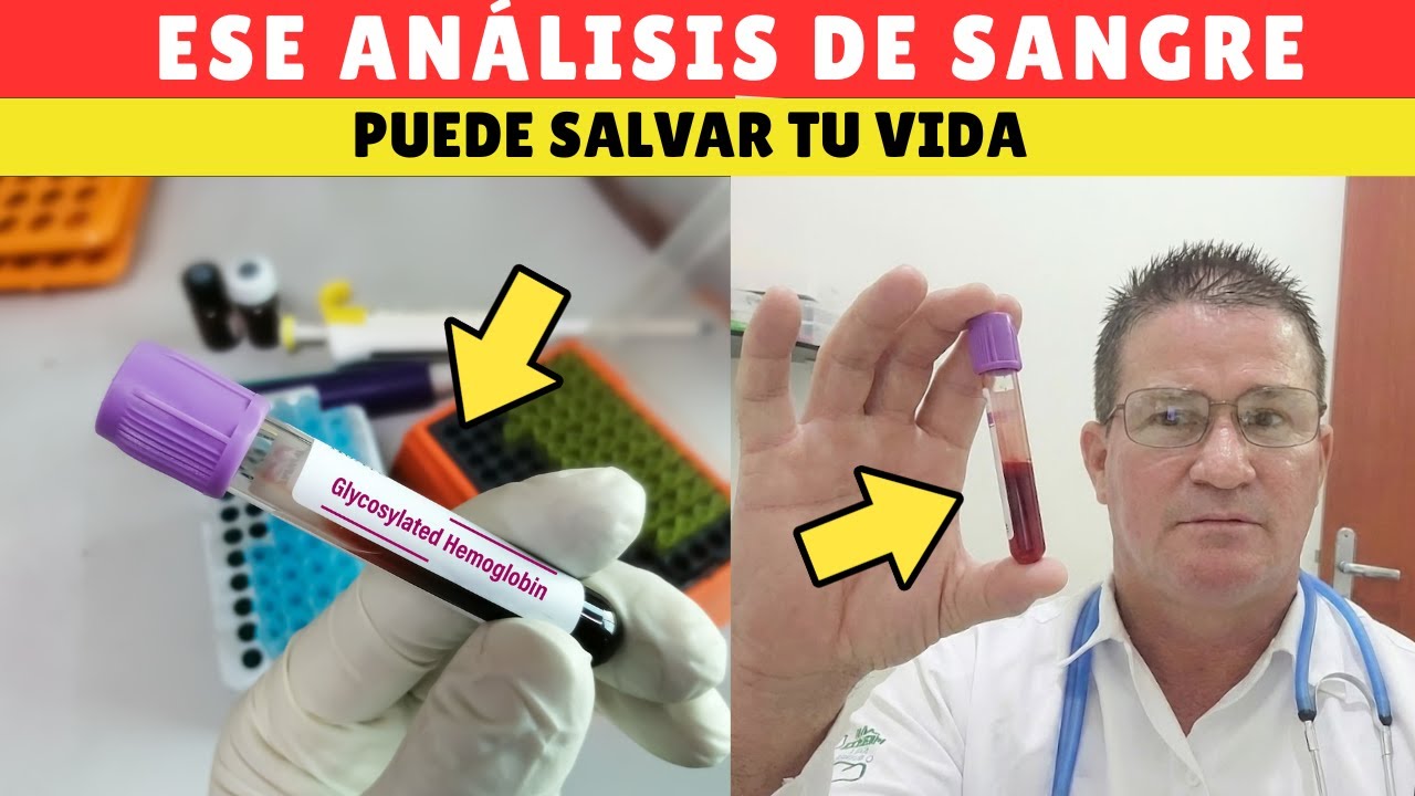 3 análisis de sangre críticos que TODOS deberían hacerse (pero muy pocos lo hacen)
