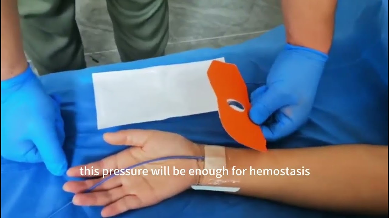 Radial Compression Device Demonstration