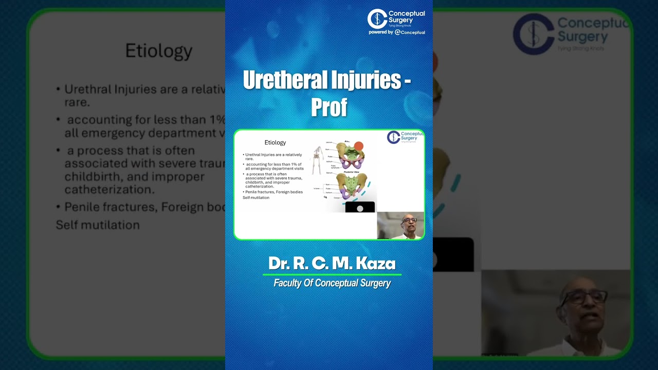 Top 5 Most Loved In-App Live Sessions of JUNE | Conceptual Surgery | Surgery Residency #shorts