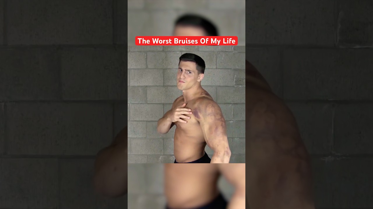 This Is What 1,000 Paintballs Did To Me 😱 