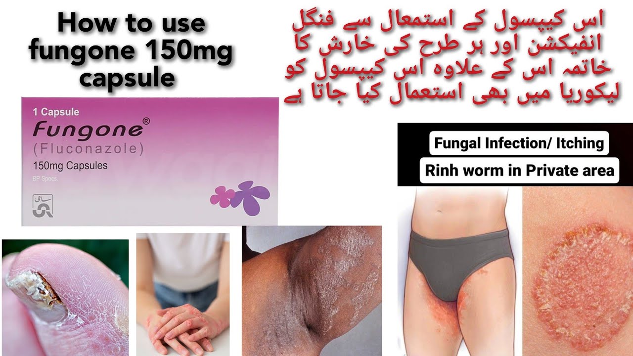 How to use fungone 150mg capsule//fungone capsule benefits and uses
