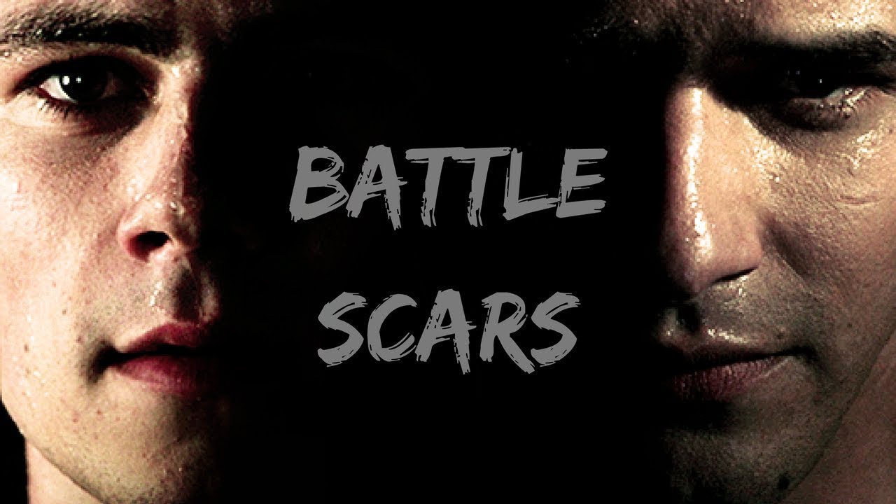 Teen Wolf || Battle Scars