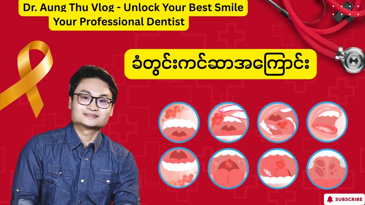 ခံတွင်းကင်ဆာအကြောင်း
