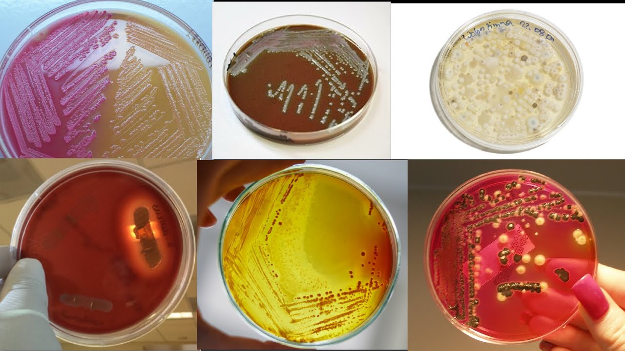 What different agar plates are for