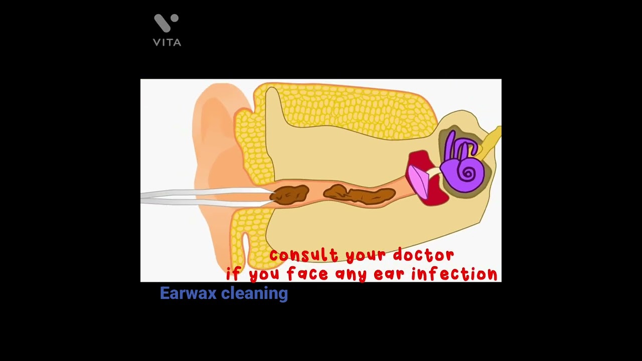 ear wax( be safe and gentle)#ear#sciencefacts #earwax#shorts