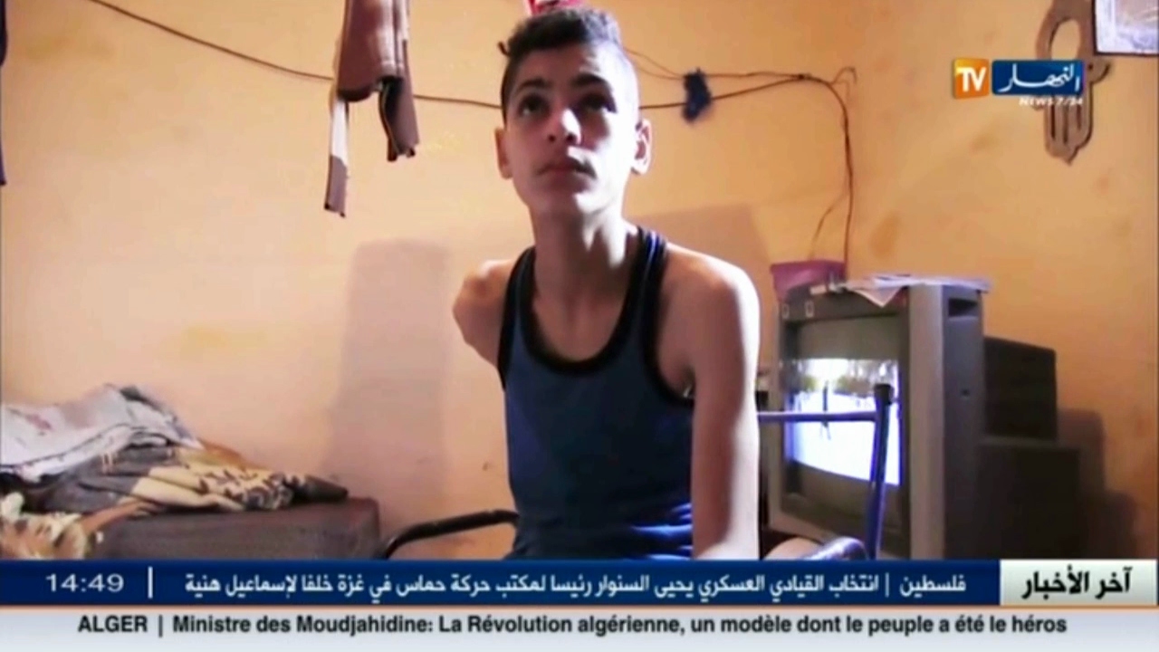 شمس الدين بين معاناة بتر ذراعه .. وأمله في عملية تنقذه من الجحيم