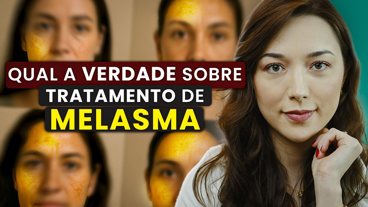 O que realmente ajuda CONTROLAR o MELASMA? I Te conto no vídeo!