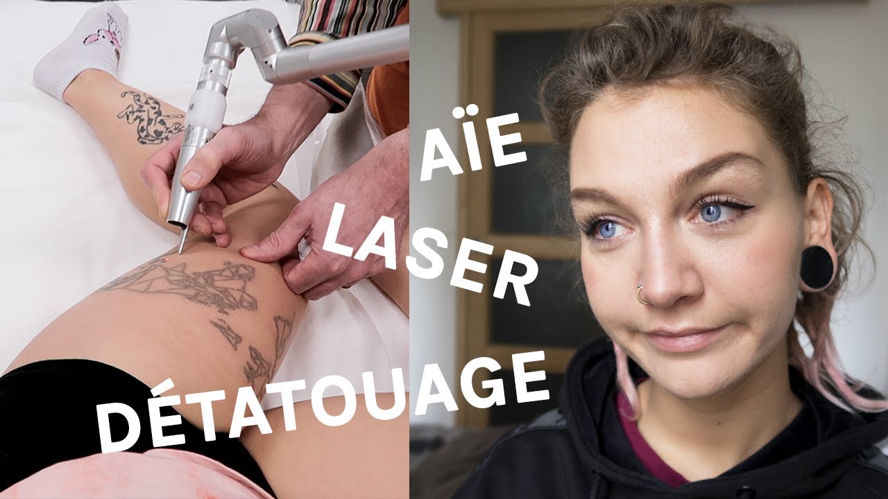 JE ME FAIS ENLEVER UN TATTOO AU LASER (séance n°5)