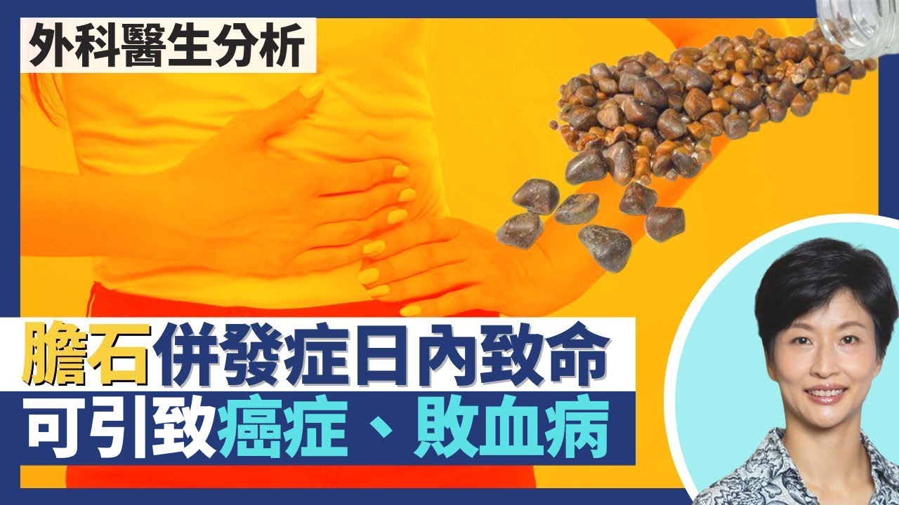 膽石引發癌症惡性腫瘤？膽石併發症一兩日內可致命！膽管炎 膽囊膽汁倒流傷肝、細菌入血變敗血病｜王建芳醫生 陳詩正醫生｜人類健康研究所