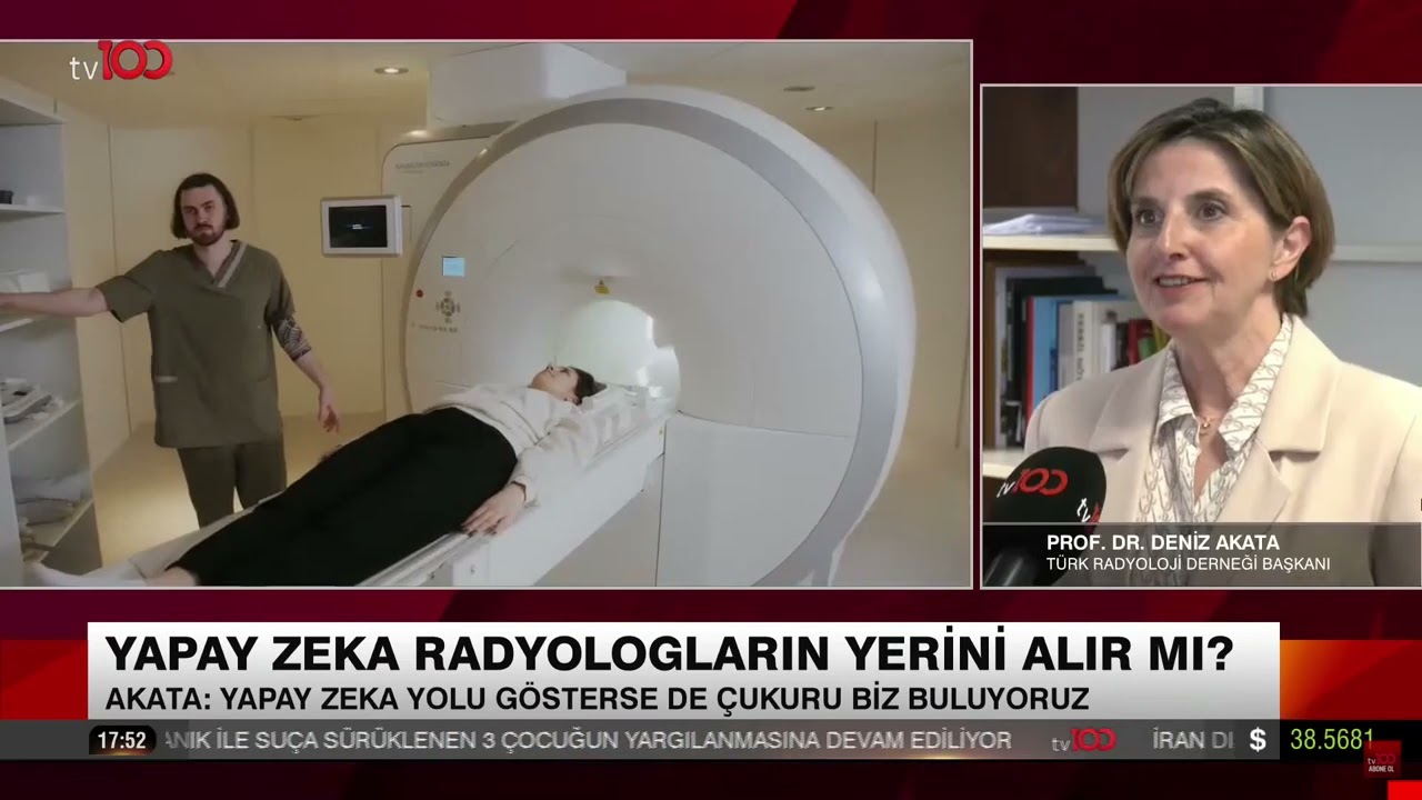 YAPAY ZEKA RADYOLOGLARIN YERİNİ ALIR MI? -WILL AI REPLACE RADIOLOGISTS?