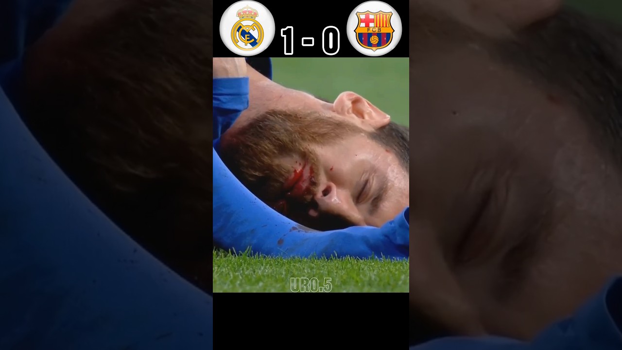 The day Messi got injured and became unstoppable