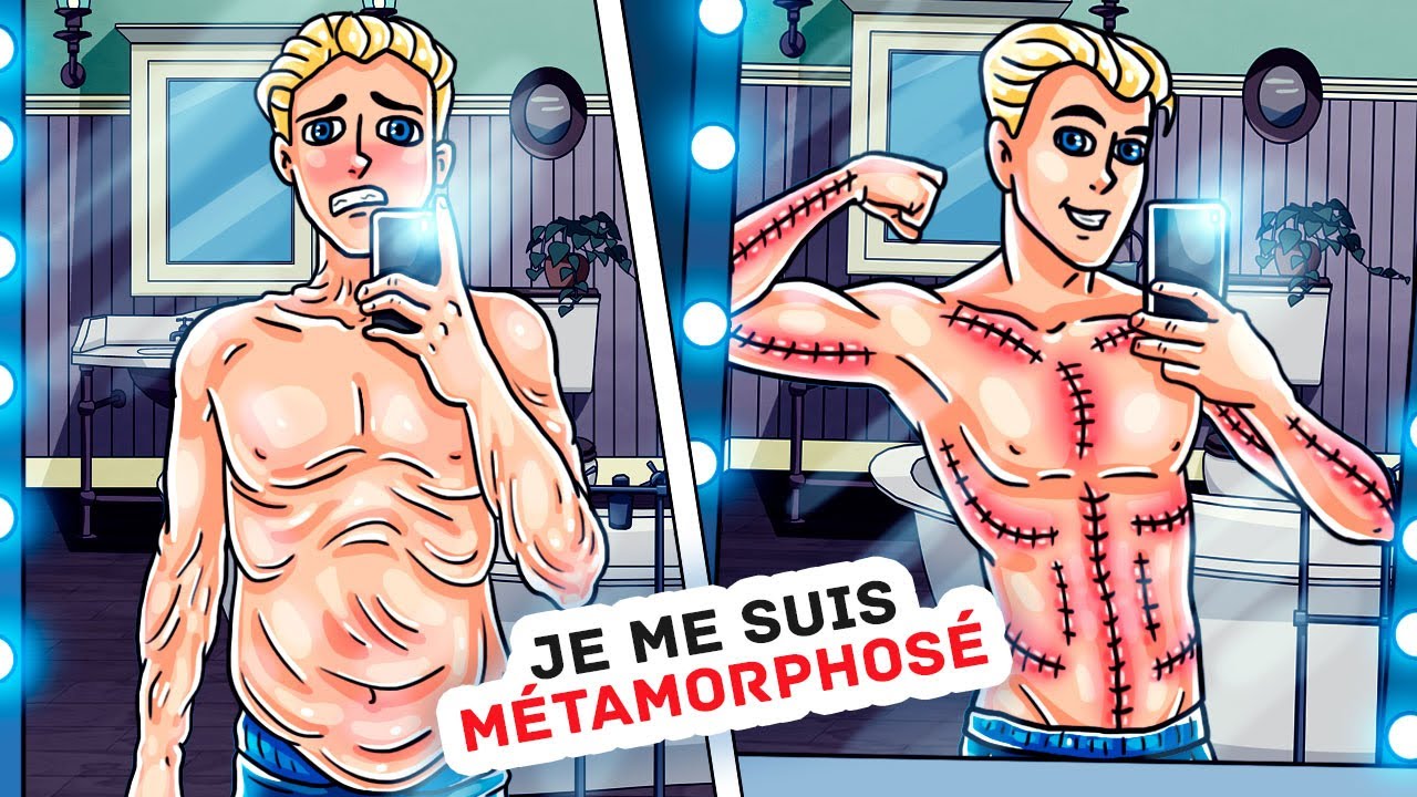 J’ai Beaucoup de Cicatrices Sur Mon Corps, Mais Je Suis Vraiment Heureux