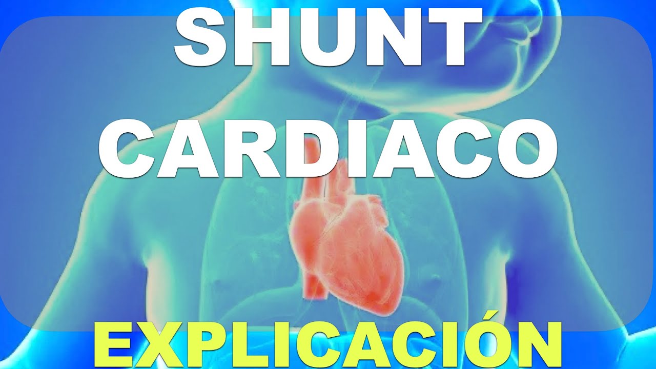Cardiopatías. Cortocircuito o Shunt.