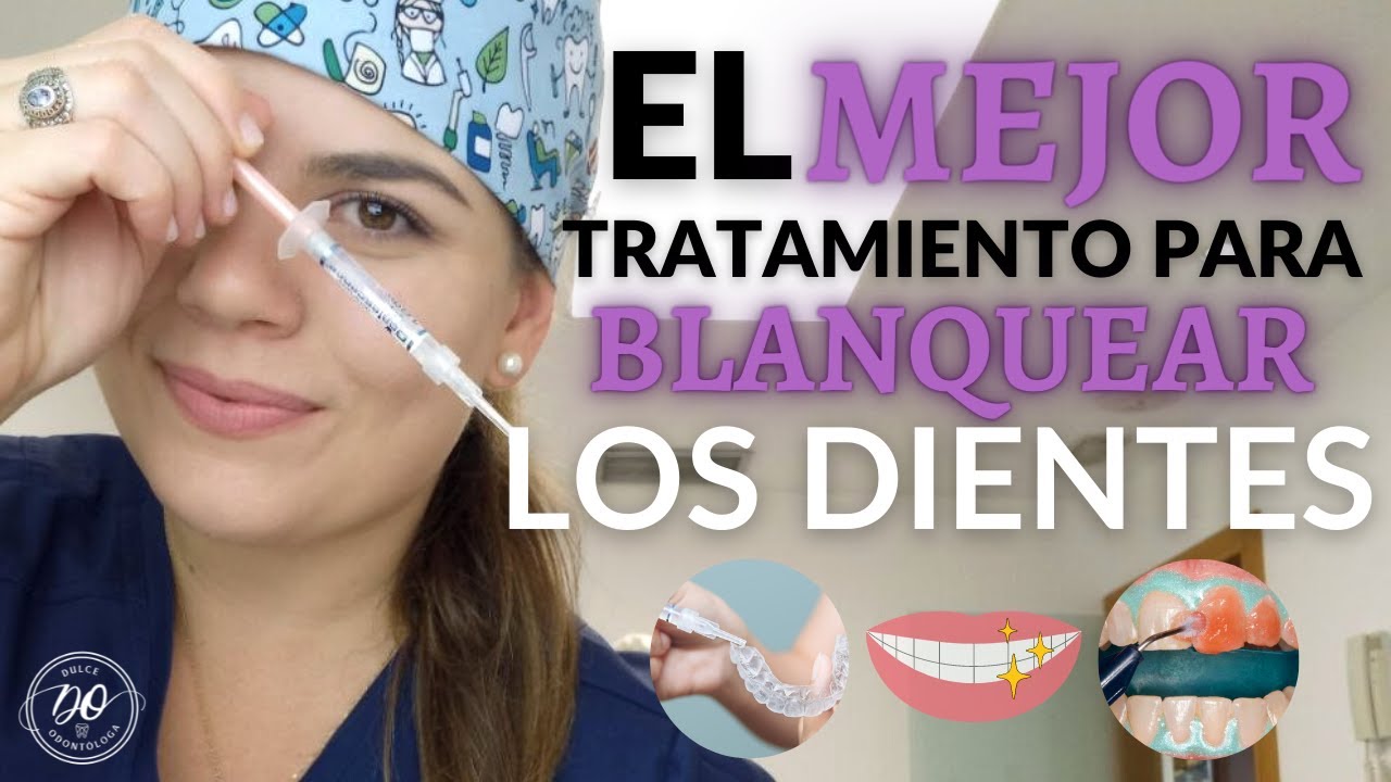 Cuál es el MEJOR BLANQUEADOR DENTAL en 2023 🦷✌️