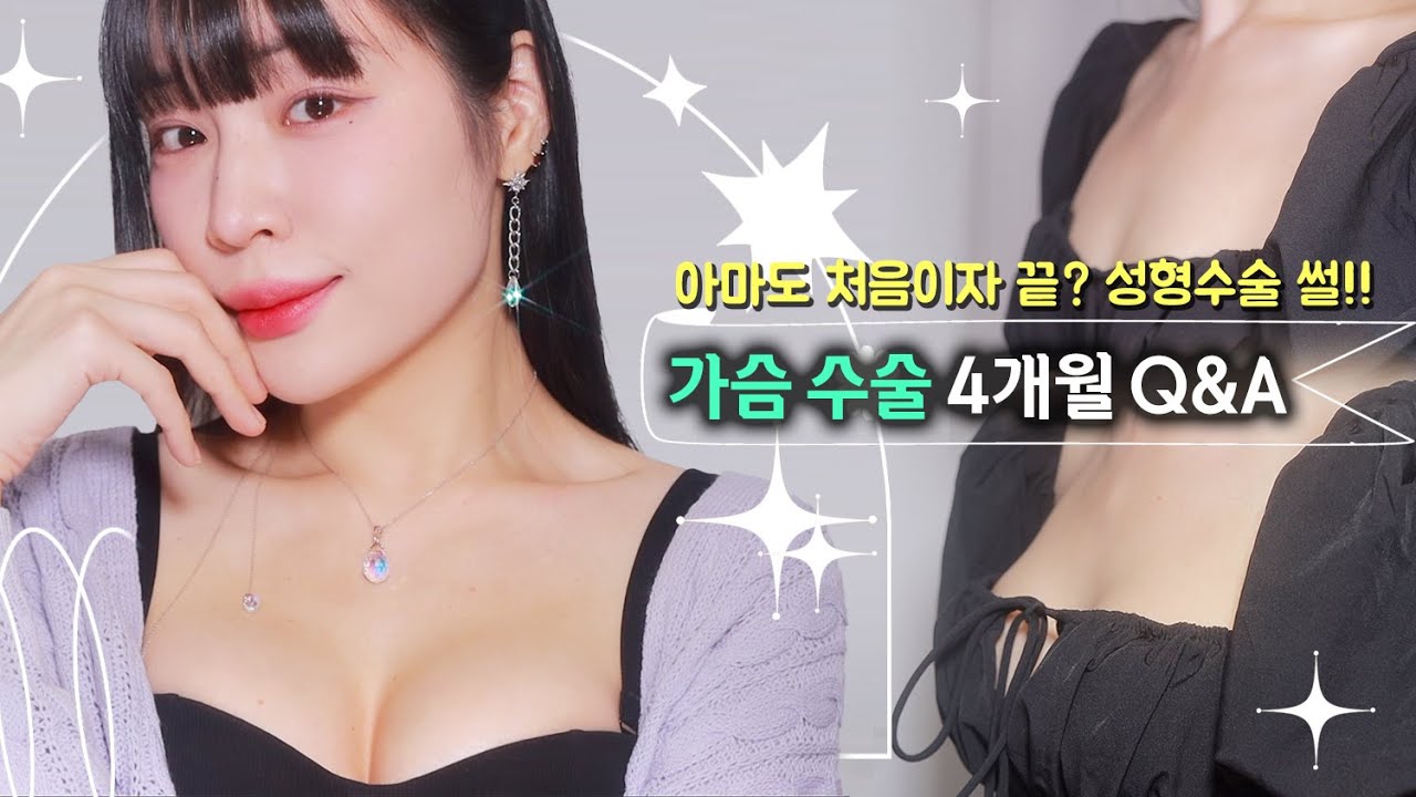 👀첫 성형수술이 가슴수술?! 새가슴 가슴 확대수술 4개월차 후기 Q&A✨밑절?겨절?모티바?용량?부작용? 말 많음⚠️[ 밀캣 / milkcat / 밀크캣 ]