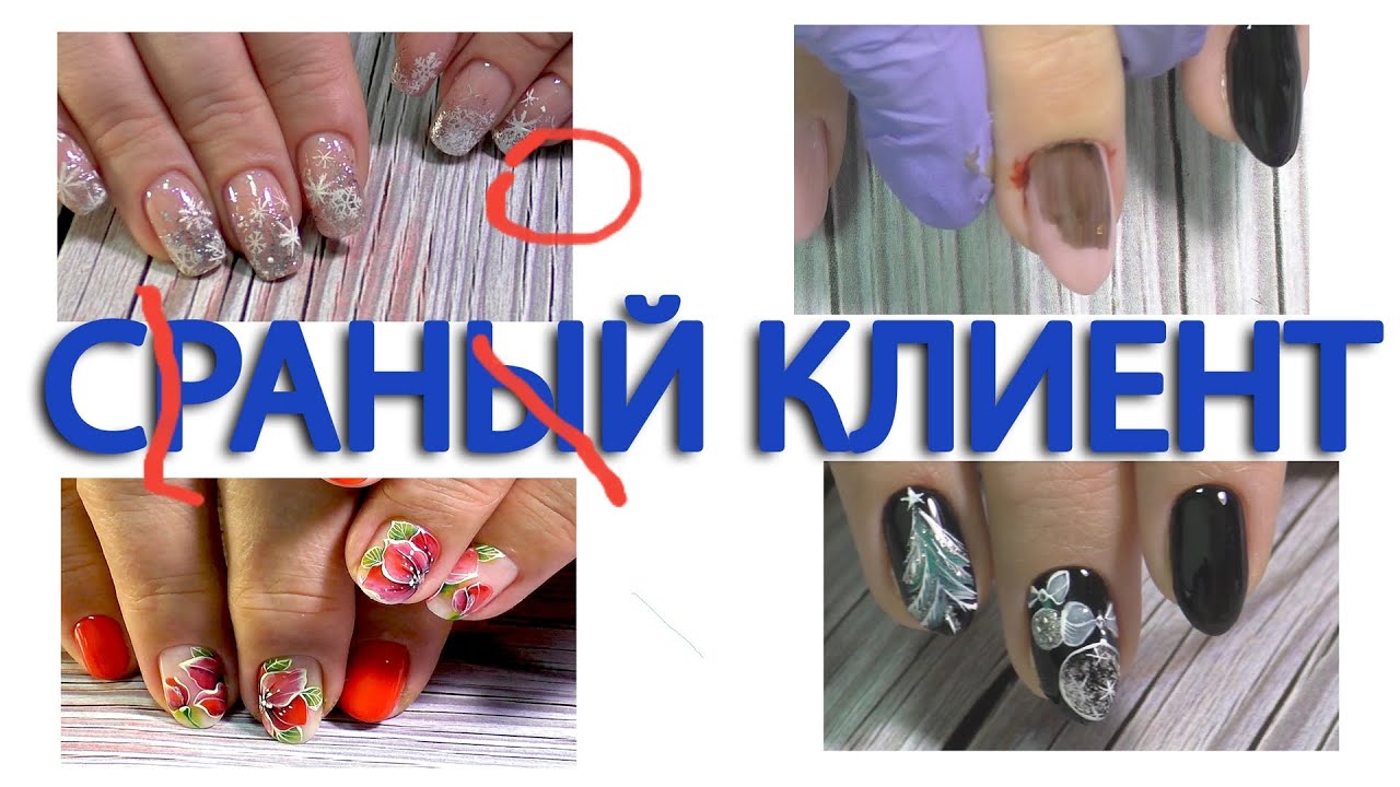 Травма, черви, два цветка. Клиент С РАНОЙ.  КРОВАВЫЙ МАНИКЮР 2020.