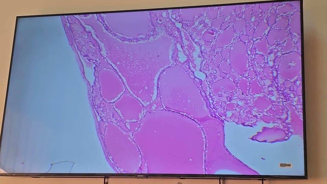CNS &Endocrine Microscope revision + Practical Exam Instructions