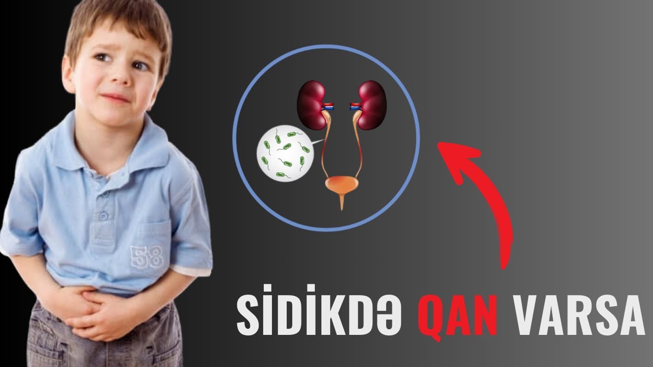 Uşaqlarda sidikdə Qan və Pis Qoxu varsa səbəbi nədir?