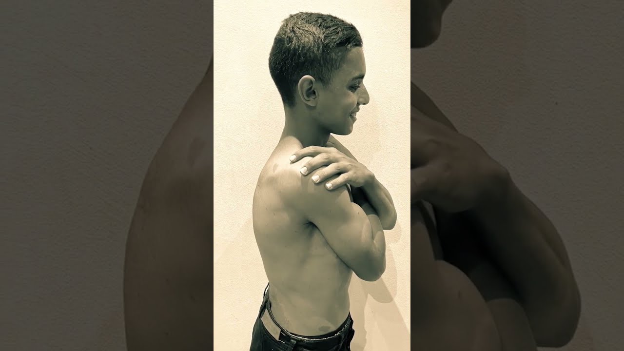 قبل وبعد جراحات تصليح تشوهات العمود الفقري