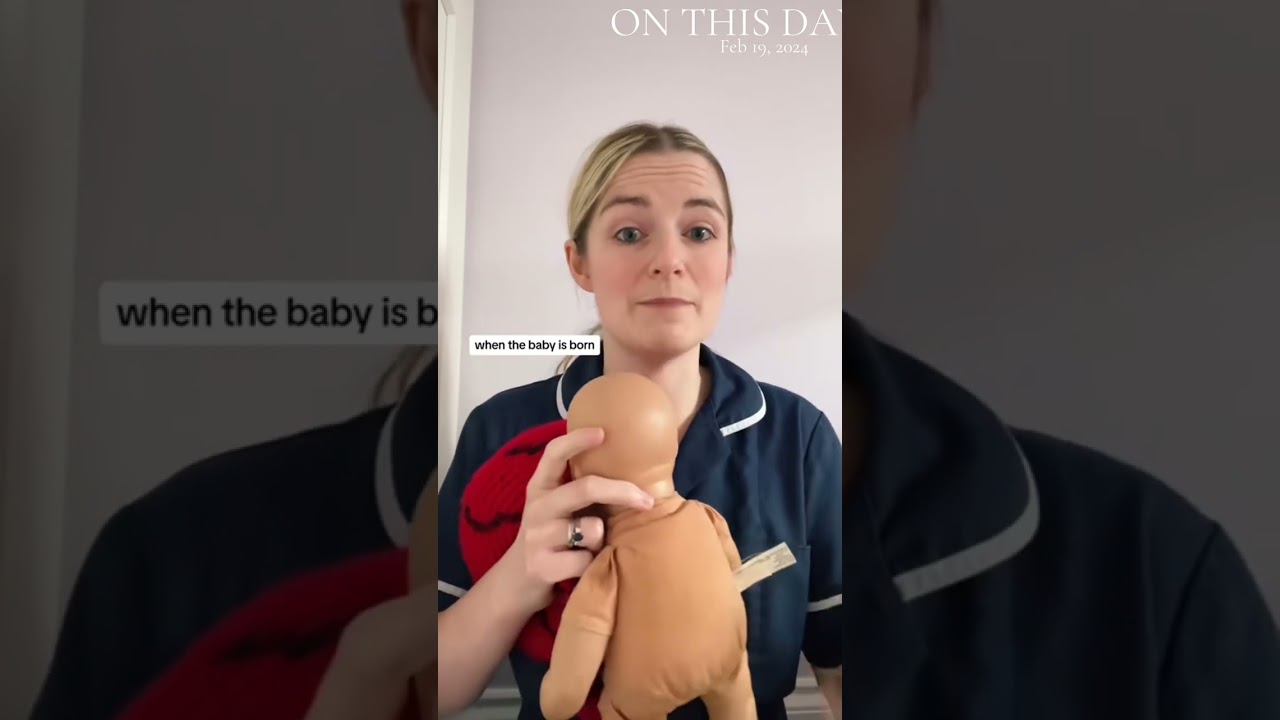 Nucal cords and birth #umbillicalcord #pregnant #pregnancy #mumtobe #havingababy #babyontheway 