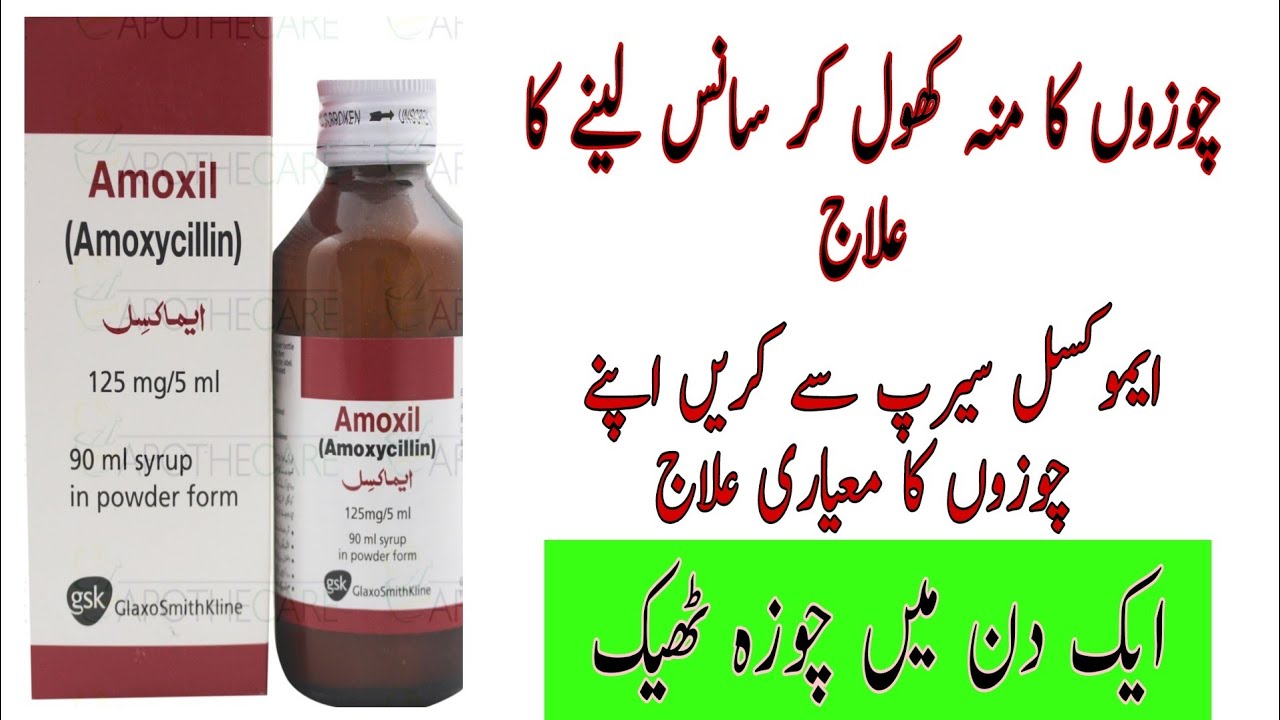 chozo ka mo khol kar sans lainy ka ilaj / Treatment of open-mouthed breathing