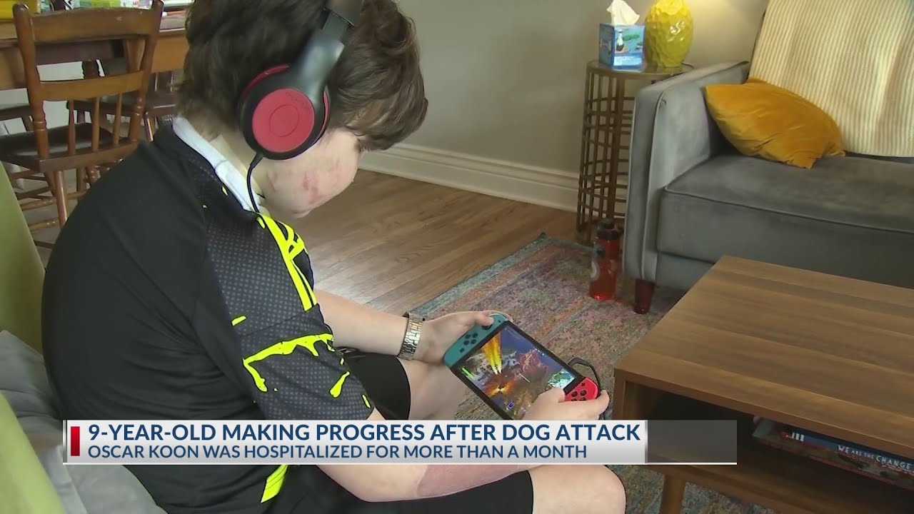 9-year-old making progress after North Linden dog attack