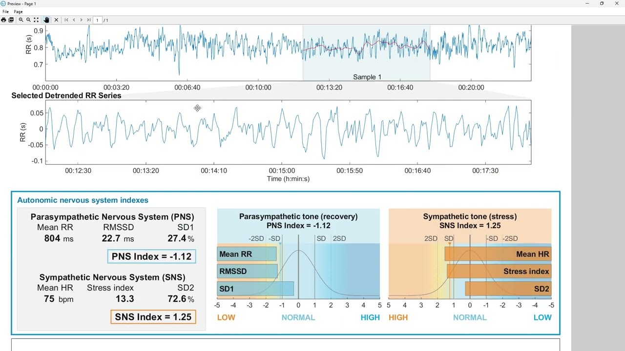 Analyzing HeartPhi Data in Kubios HRV Standard