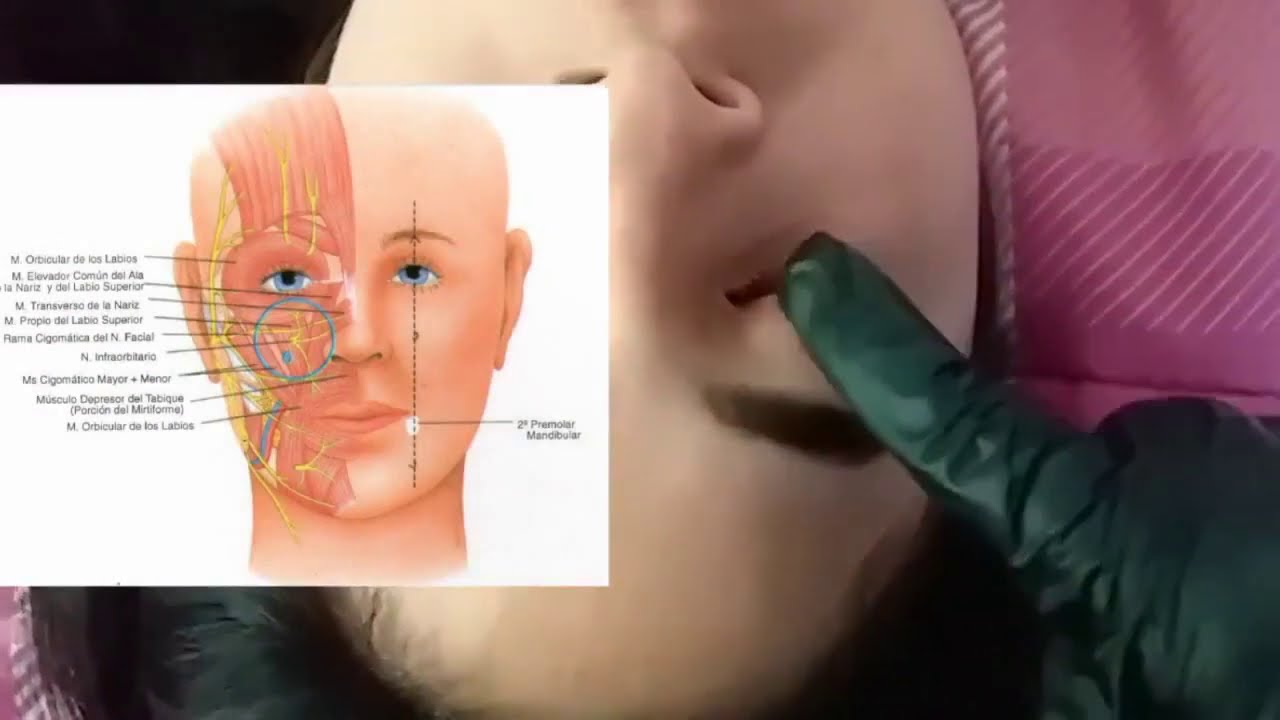 Zonas faciales peligrosas.