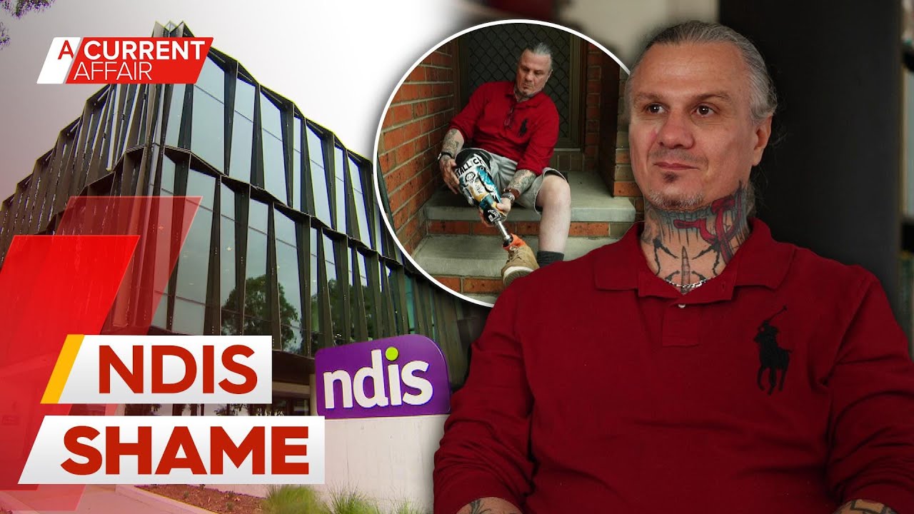 NDIS recipient asked to prove prosthetic leg is a permanent disability | A Current Affair
