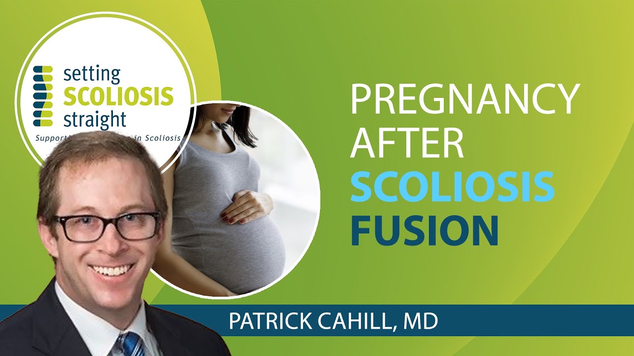 Pregnancy After Scoliosis Spinal Fusion Surgery