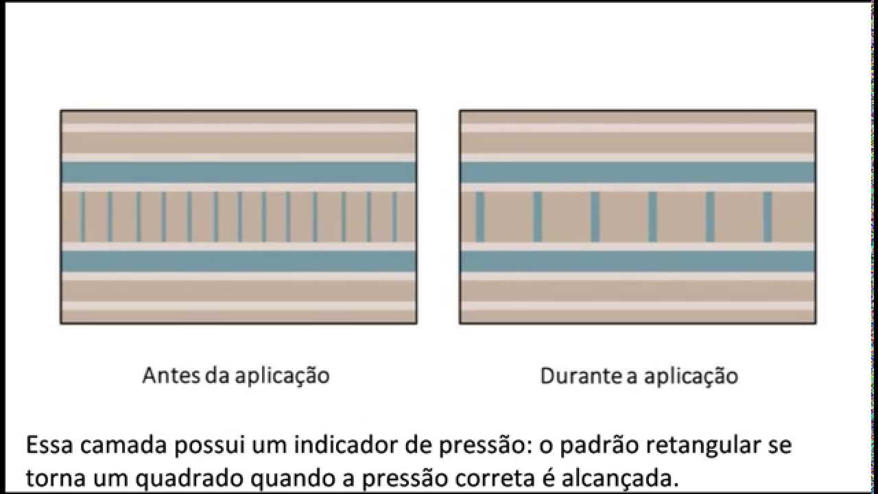 DYNA-FLEX Sistema de Compressão Multicamadas