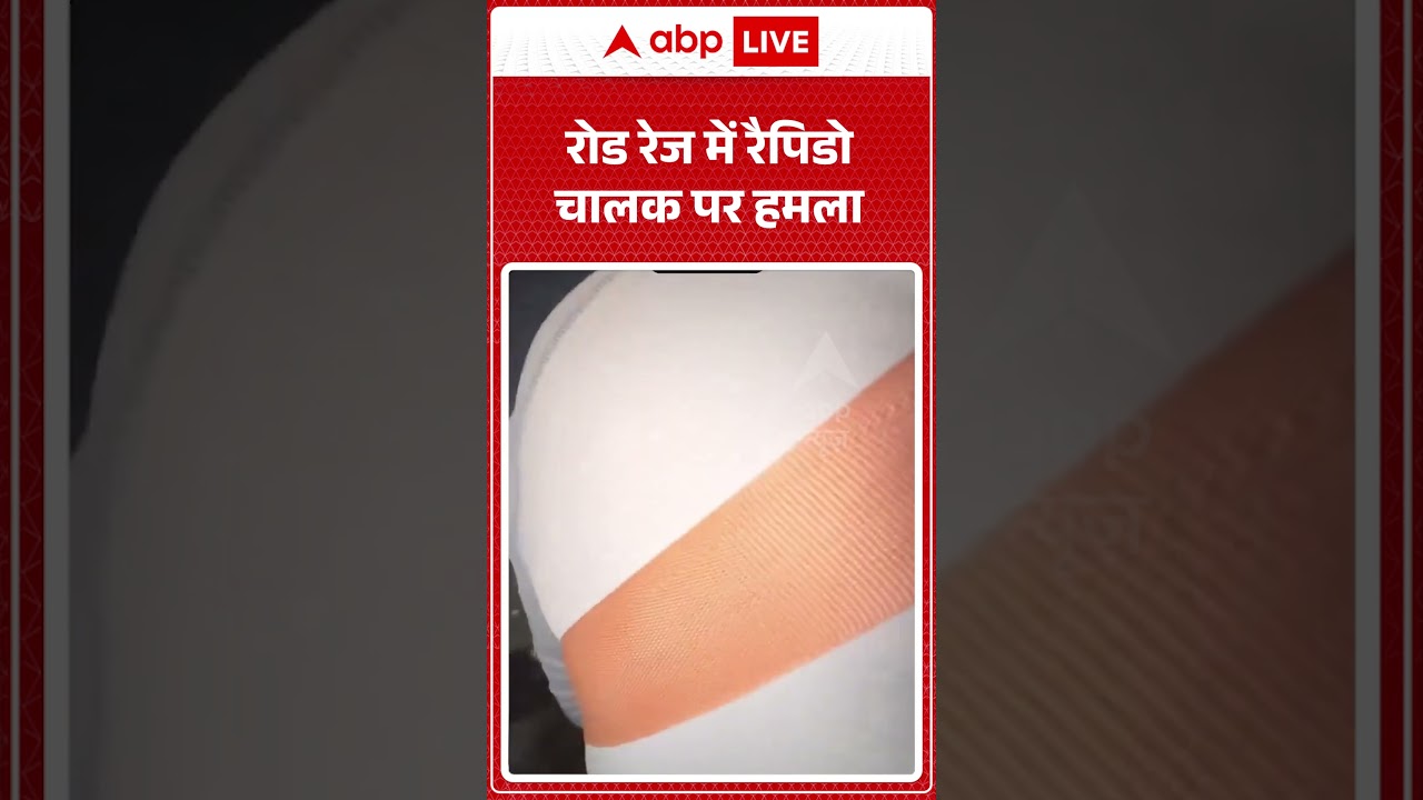 Viral News : रोड रेज में रैपिडो चालक पर हमला | #ytshorts #roadrage #fight #viral #viralvideo