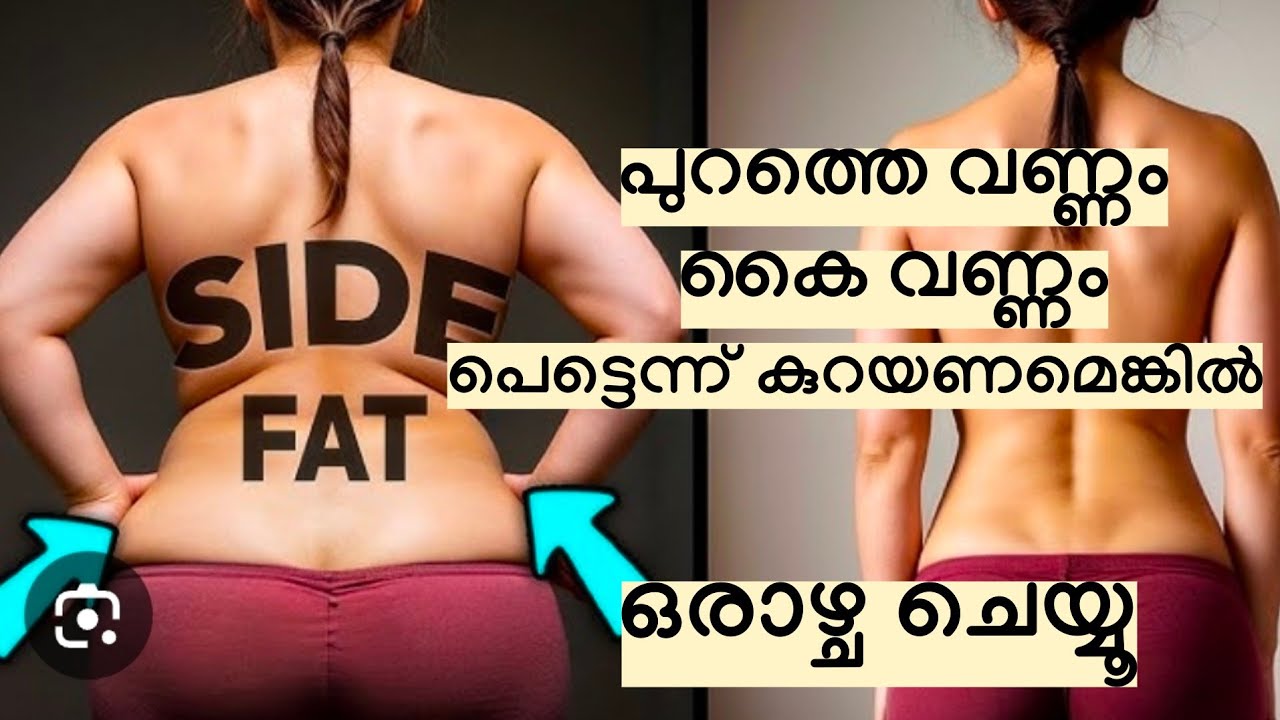 പുറത്തെ വണ്ണം കൈ വണ്ണം പെട്ടെന്ന് കുറയണം എങ്കിൽ ഇത് ഒരാഴ്ച മാത്രം ചെയ്യൂ // 100% result ❤️👍