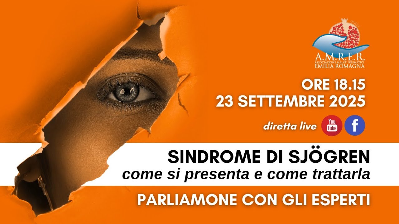 Sindrome di Sjögren