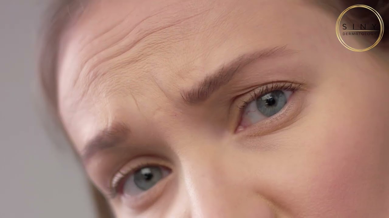 The Science Behind Skin Aging - What Really Causes Wrinkles?