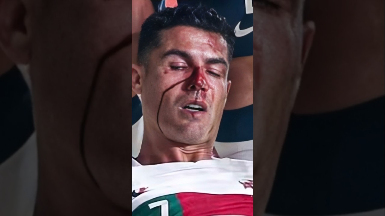 Ronaldo&rsquo;s Serious Car Accident #shorts