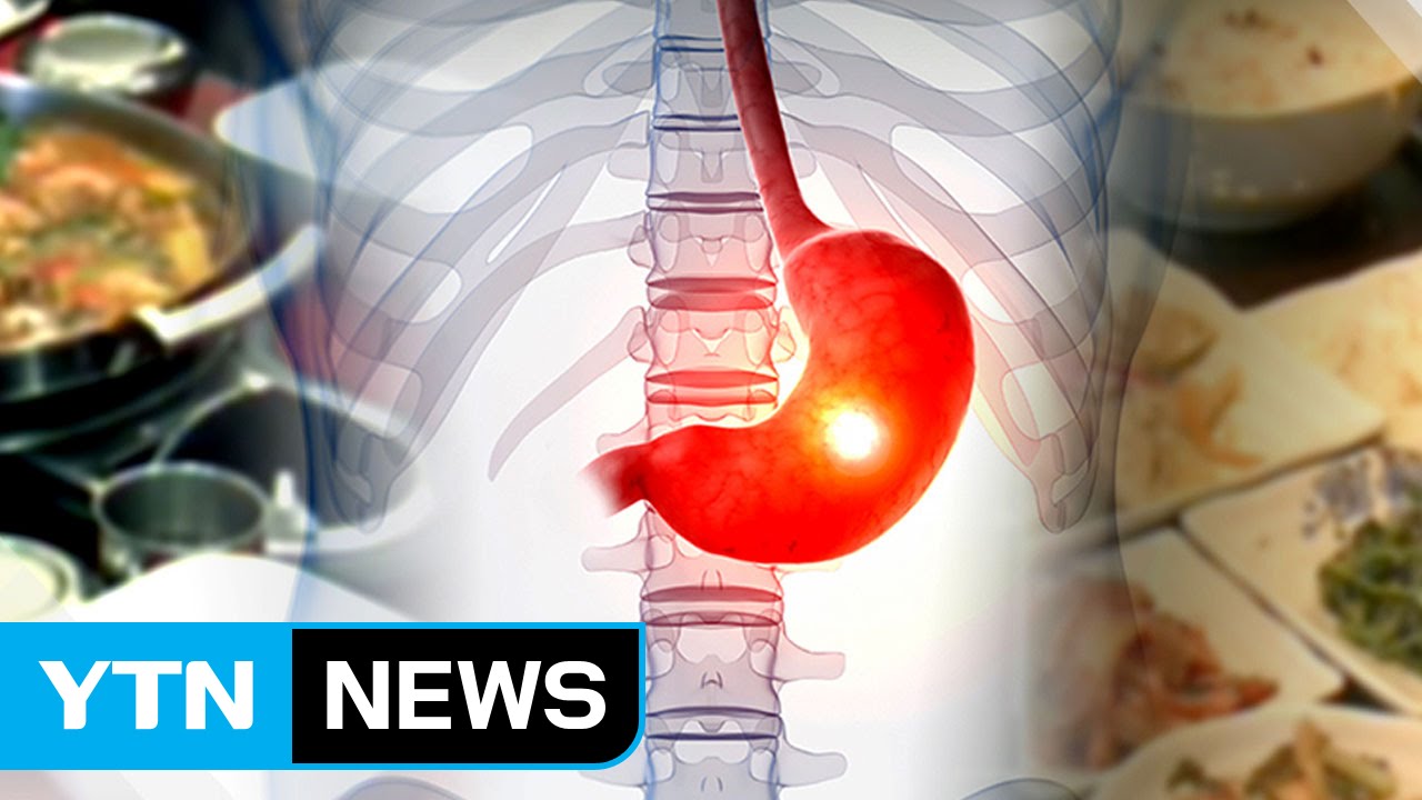 암 예방의 날...한국인 위암 예방 수칙 7계명 나왔다 / YTN (Yes! Top News)