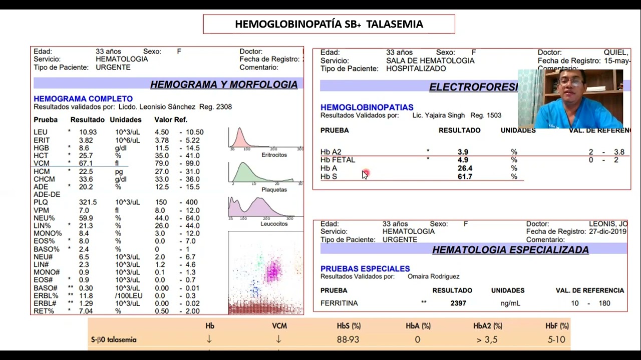 HEMOGLOBINOPATÍA SB+ TALASEMIA